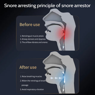 Electric Anti Snoring Device